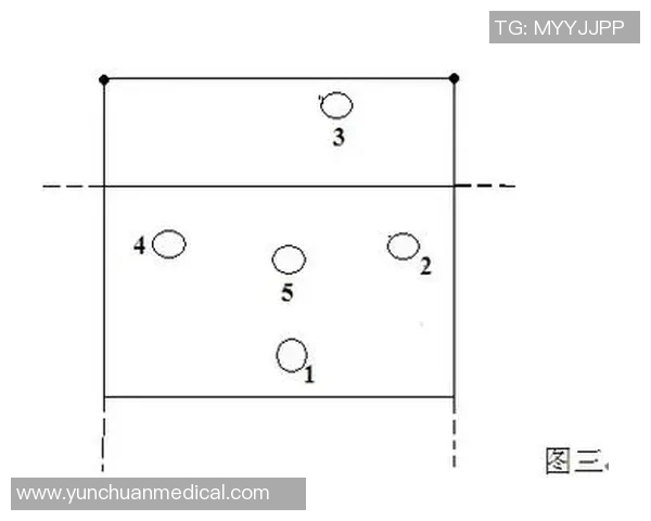 杭州排球队整体压制战术解析与排球热点探讨